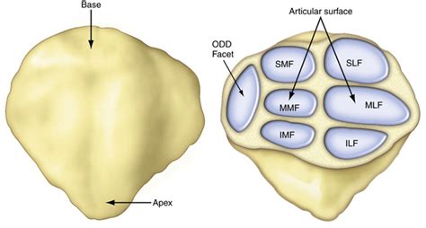 odd facet|patella ridge.